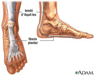 Fascitis plantar: una de les lesions ms comuns entre els corredors | EbreActiu.cat, revista digital d’oci actiu | Terres de l’Ebre ...